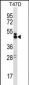 SLAMF6 Antibody (C-term)